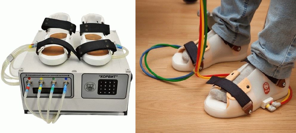 Рады сообщить,что в отделении НПЦ ДП на улице ул. Гарибальди, д. 8к6 появился аппарат "КОРВИТ" «космические ботинки»